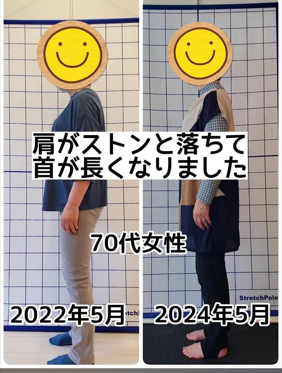 70代女性｜肩がストンと落ちて、首が長くなりました