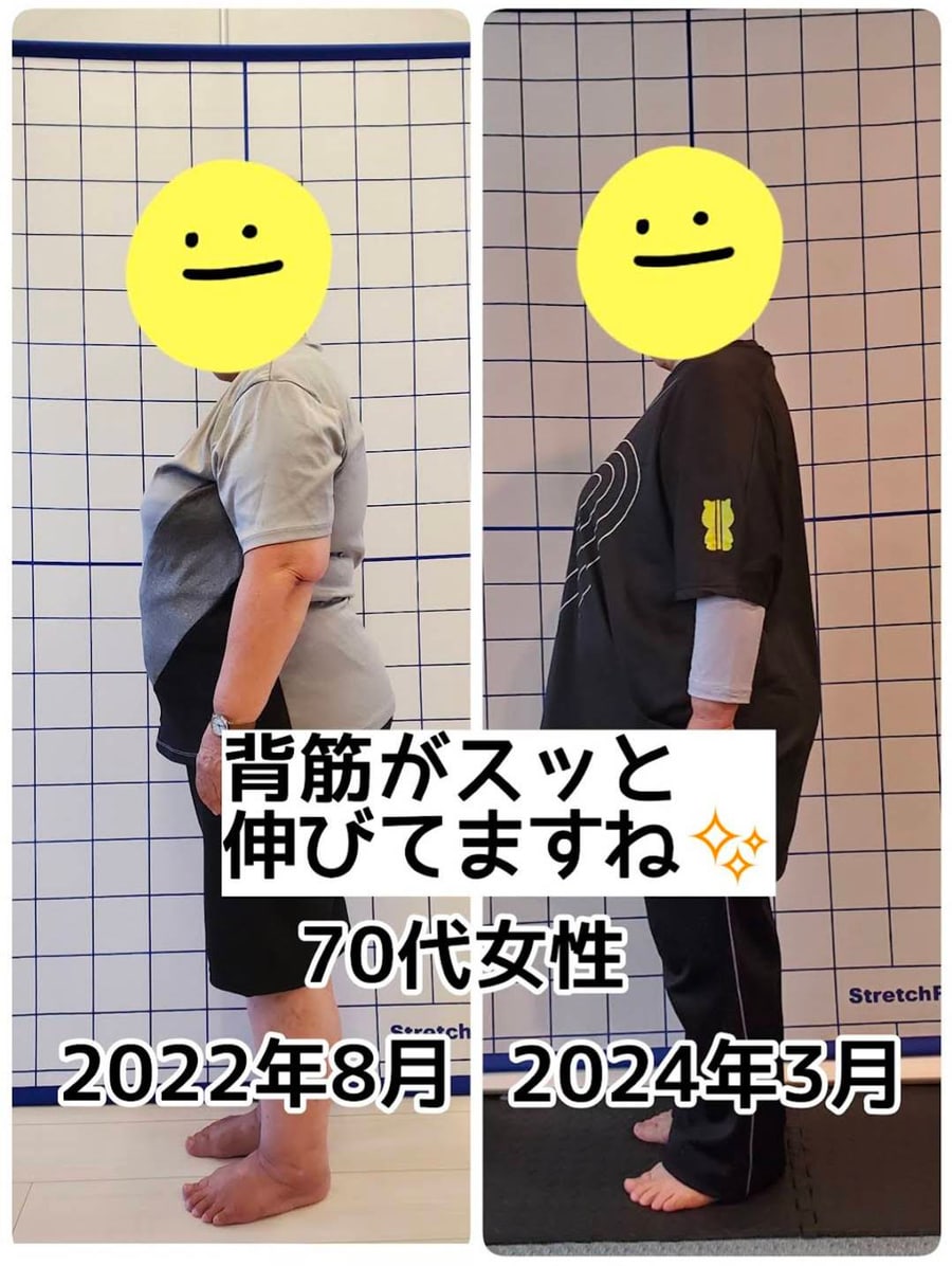 70代女性｜背筋がスッと伸びました